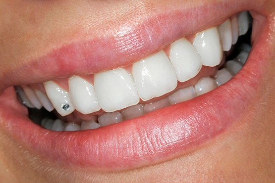 Tooth hotsell jewelry cost
